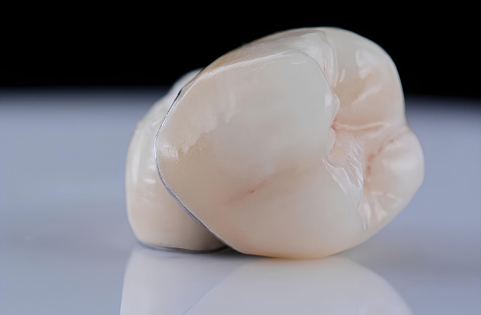 What Does a Dental Crown Look Like?